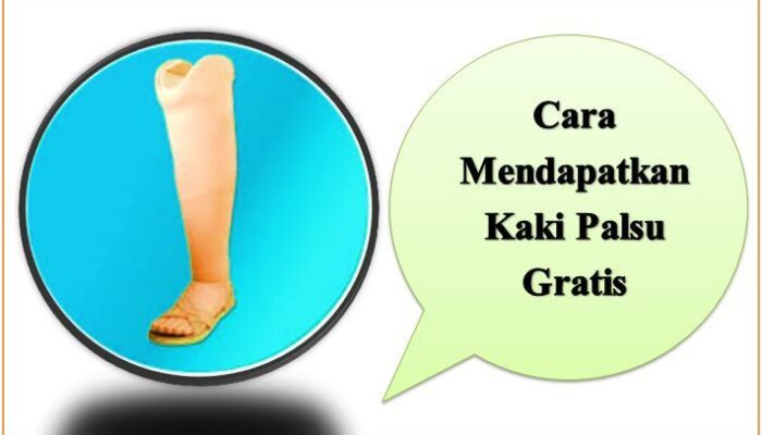 Cara Mendapatkan Kaki Palsu Gratis